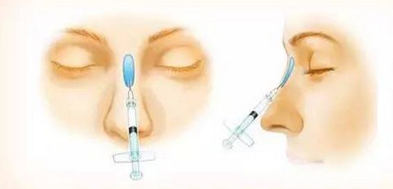 吉林哪家醫(yī)院的雙眼皮手術(shù)效果好？