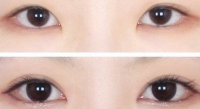 西安王者風(fēng)范嫩膚哪家好？一文讀懂西安嫩膚機(jī)構(gòu)排行榜