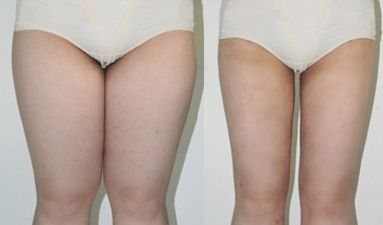 西安北郊美容整形哪家好？揭秘西安北郊最受歡迎的美容整形機(jī)構(gòu)排名