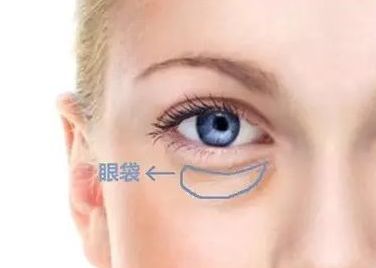 蘇州哪家醫(yī)院治療黃褐斑效果好？