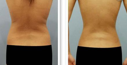 【2023最新】蘭州哪家醫(yī)院治療祛紅血絲效果好？