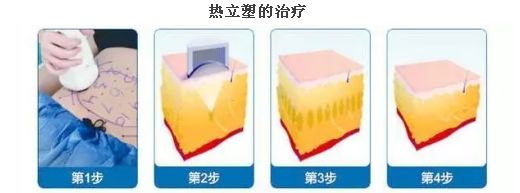 上海臉部祛斑哪家醫(yī)院好？揭秘上海市最受歡迎臉部祛斑醫(yī)院排行榜