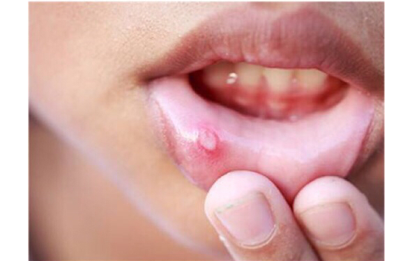 2023青島腹部減肥排名前十名的醫(yī)生(侯倩、羅良芬、龐東劍綜合性更強)