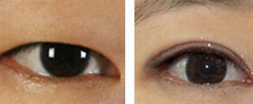 2023大連肉毒素注射治療腋臭醫(yī)生綜合實力口碑排行(閆潤虎、張翼飛、李嬌蕾網(wǎng)友：口碑好價格也不貴)