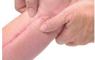 廣州哪家美容醫(yī)院好？詳細比較廣州頂級醫(yī)療機構個美容醫(yī)院的優(yōu)缺點