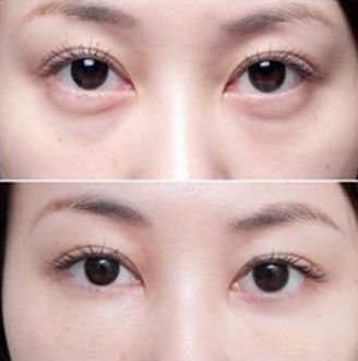 杭州厚唇變薄醫(yī)院哪家好？