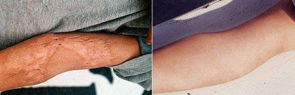 北京下顎骨手術(shù)哪家好？全面解析北京市優(yōu)質(zhì)下顎骨手術(shù)醫(yī)院及醫(yī)生推薦