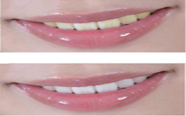 2023鄭州隔空溶脂瘦手臂正規(guī)醫(yī)生評價前10強(蔣秀娟、牛永敢、楊勝發(fā)個人簡介、技術優(yōu)勢分析！)