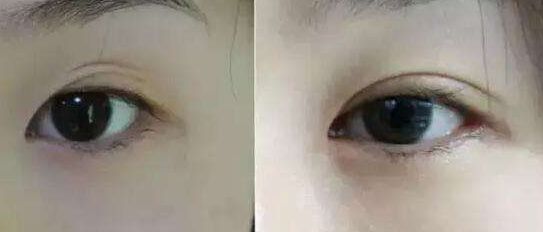 南京哪家假體豐胸醫(yī)院好？醫(yī)術(shù)精湛、效果明顯的南京豐胸專科醫(yī)院推薦