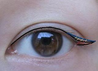 2023昆明隆胸整形哪家醫(yī)院好？專家推薦與真實(shí)案例一覽