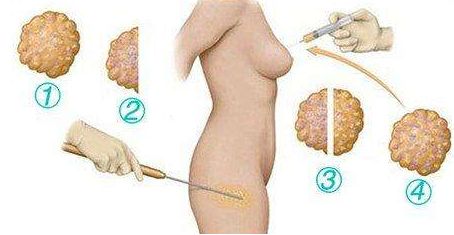 上海市排名靠前的專業(yè)祛疤痕醫(yī)院有哪些？