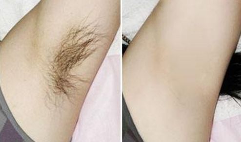 成都M唇做的好的醫(yī)院有哪些？