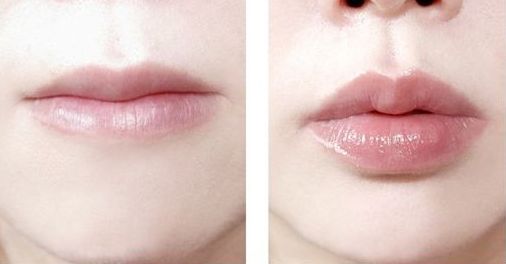 南京哪家醫(yī)院治療黃褐斑效果好？