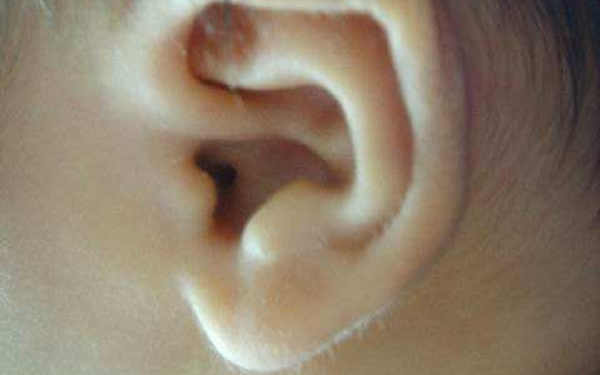 杭州華山程琳整鼻術(shù)態(tài)度與效果亮眼，醫(yī)師傳世之匠藝悅目案例展示