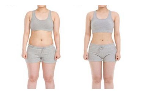 上海哪家醫(yī)院能有效去除妊娠紋，讓肌膚重新恢復(fù)緊致？