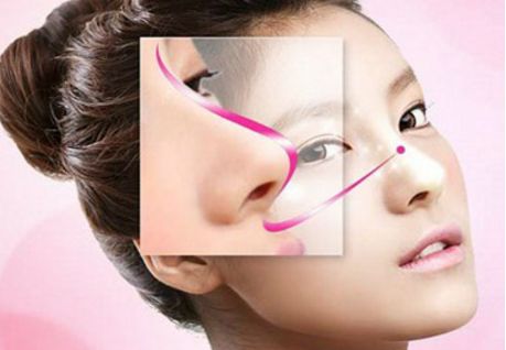 深圳駝峰鼻矯正哪家好？專業(yè)醫(yī)生推薦與真實案例分享！