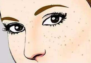 上海范榮杰醫(yī)生鼻部整形案例詳解，效果如何？