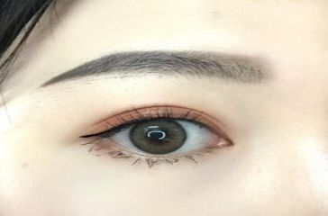 上海去黑眼圈哪個醫(yī)院好？專家推薦的實力醫(yī)院排行榜