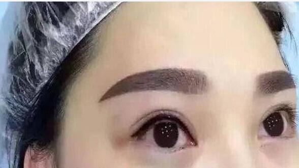 北京史三八整形醫(yī)院李珠賢紋眉口碑評(píng)價(jià)如何？