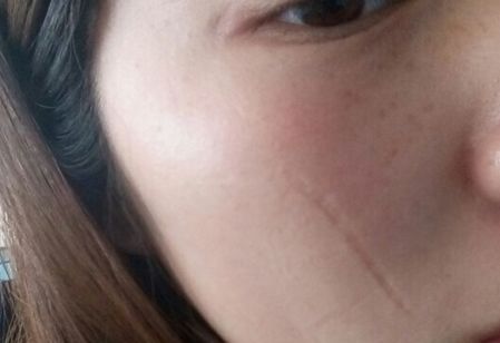 濟(jì)南哪家醫(yī)院做豐胸效果好？排名靠前，技術(shù)專業(yè)的有哪些？