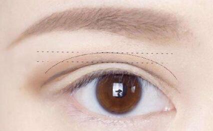 深圳哪家整形醫(yī)院可以幫助您實(shí)現(xiàn)張瑩的隆胸愿望