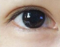 蘇州哪家祛痘醫(yī)院好？專家推薦的治療痘痘效果好的醫(yī)院