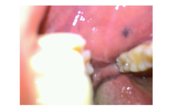 2023寧波飛梭點陣激光權威醫(yī)生排行TOP10(胡文瑜、費安軍、阮凱超多公立推薦)