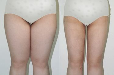 南京雀斑祛除十強(qiáng)診所：專業(yè)技術(shù)，效果顯著