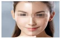 吃海鮮對于使用瘦腿針的人來說是否適合？