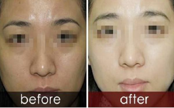 曬黑后如何迅速變白？曬黑美白需要持續(xù)護理多久結果可見？了解曬后護膚科普！