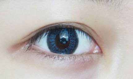 淮南市醫(yī)院有做雙眼皮手術(shù)嗎？手術(shù)技術(shù)如何？價格如何？實例解析給您參考