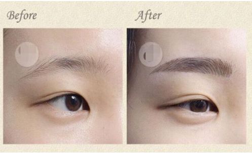 成都華西口腔種植牙費用一覽表出爐！想了解非常受歡迎的五位醫(yī)生？