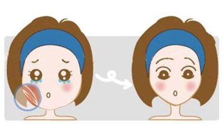 新疆整形醫(yī)院鼻部手術(shù)效果如何？預(yù)約掛號(hào)是否復(fù)雜？美麗鼻型展現(xiàn)，了解方法！