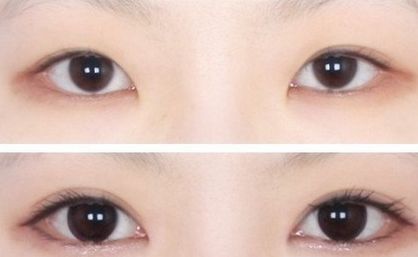 南京中醫(yī)院優(yōu)秀雙眼皮專(zhuān)家推薦，值得信賴(lài)！完善的醫(yī)生介紹、項(xiàng)目介紹及價(jià)格表供參考