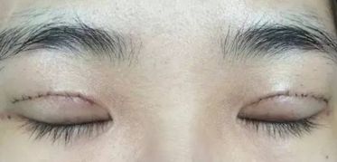 云大醫(yī)院整形外科—科室實(shí)力、專家團(tuán)隊(duì)及患者評價(jià)揭秘