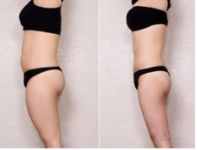 上海長征醫(yī)院引領植發(fā)領域，李宇飛頗受好評，專家名單曝光！