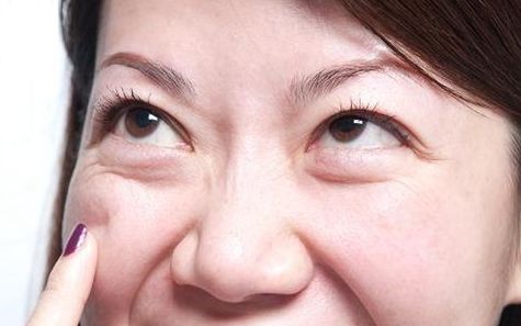 上海九院去眼袋專家推薦，最全擅長項(xiàng)目及費(fèi)用一覽