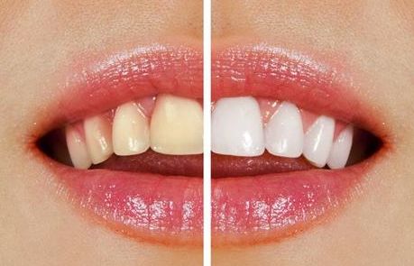 榆林市第一醫(yī)院最牛眼科專(zhuān)家曝光！秒懂近視眼手術(shù)真相