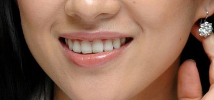 探尋西安藝星宋蔚雙眼皮技術(shù)，深度解析醫(yī)生實力與經(jīng)典案例分享