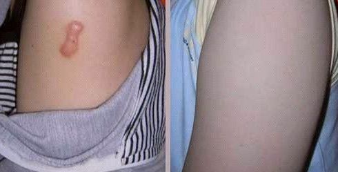 天津河?xùn)|美萊醫(yī)學(xué)醫(yī)院受推崇的全雙醫(yī)生吸脂術(shù)是否靠譜？