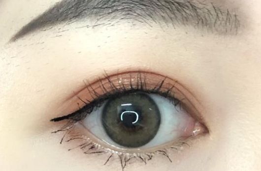 深圳保麗圣瑞整形醫(yī)院面部脂肪填充2023案例分享，效果好嗎？