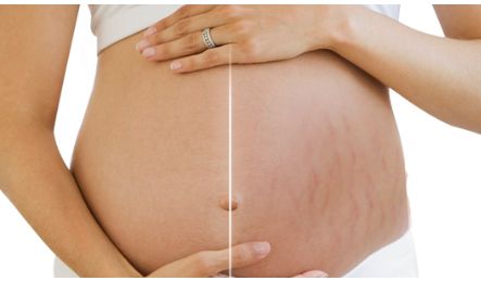 柳大烈的下頜角磨骨手術(shù)：醫(yī)生實(shí)力揭秘及成功案例分享