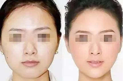 南京華美美容醫(yī)院：值得信賴的專業(yè)醫(yī)生、熱門項目和滿意口碑