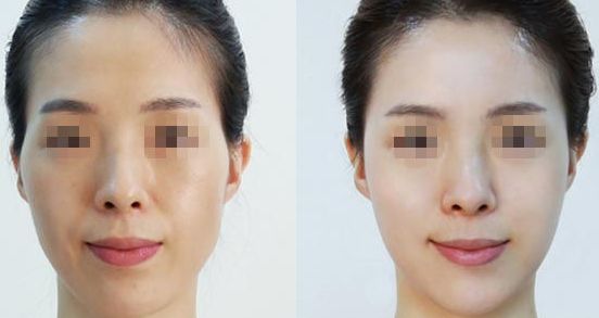 南寧亞太整形醫(yī)院：專家云集，口碑相傳