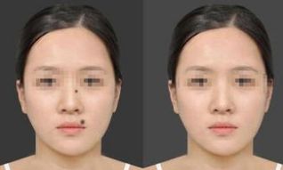 天津疤痕修復(fù)名院盤點(diǎn)：醫(yī)大總院、南開醫(yī)院、美萊位列前茅