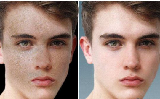 2024中國假體隆胸權(quán)威醫(yī)院指南：上海、北京、廣州、武漢