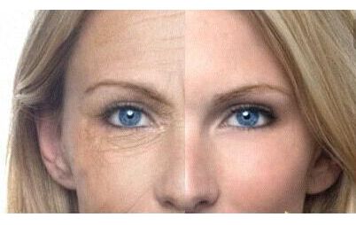 上海華美謝衛(wèi)國醫(yī)生：隆鼻案例驚艷，塑造完美鼻型效果太真實