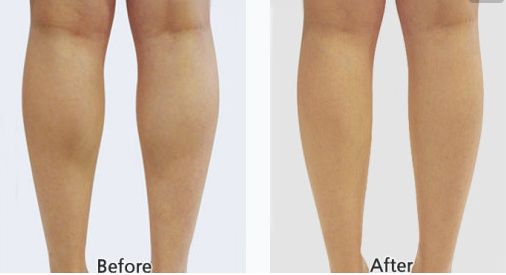 射頻緊膚整形醫(yī)院排行榜，專家推薦的三家一流醫(yī)院震撼上榜