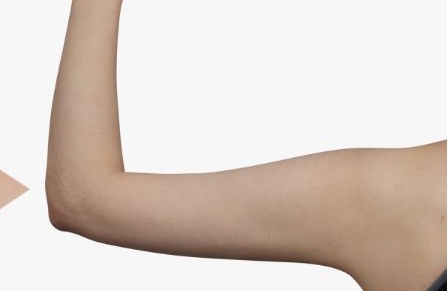 銀川陳勇博士醫(yī)療美容整形醫(yī)院醫(yī)生團(tuán)隊是否備受認(rèn)可？他們的案例能夠展現(xiàn)多少成功經(jīng)驗？