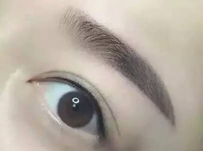 周兆平醫(yī)生雙眼皮手術(shù)需等候排隊(duì)嗎？醫(yī)生經(jīng)歷&案例顯示，2023瞳瞳提升策略！